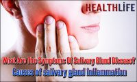What Are The Symptoms Of Salivary Gland Disease
