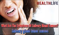 What Are The Symptoms Of Salivary Gland Tumors