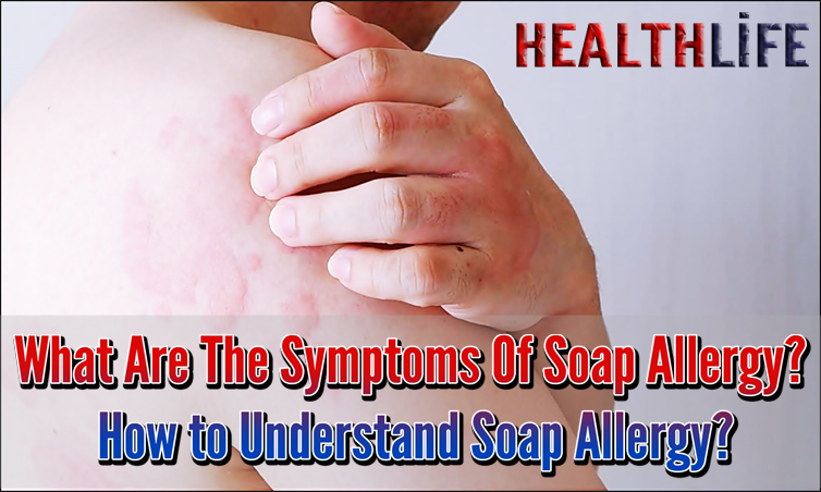 What Are The Symptoms Of Soap Allergy