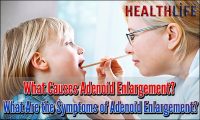 What Causes Adenoid Enlargement