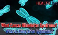 What Causes Klinefelter Syndrome