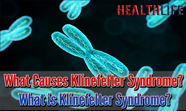 What Causes Klinefelter Syndrome