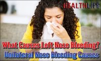 What Causes Left Nose Bleeding