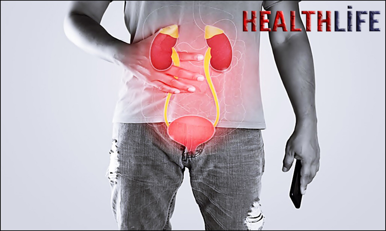 What Is The Most Common Underlying Cause Of Nephrotic Syndrome