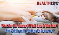 How Can I Regain Fluid In My Knee