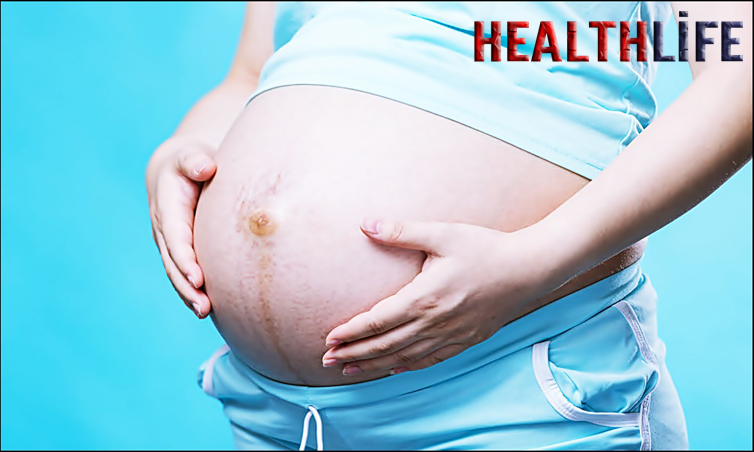 How Do I Check Myself For An Umbilical Hernia