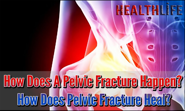 How Does A Pelvic Fracture Happen