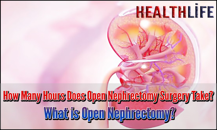 How Many Hours Does Open Nephrectomy Surgery Take
