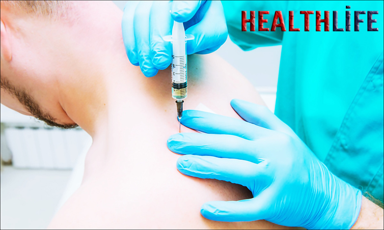 How Painful Are Trigger Point Injections