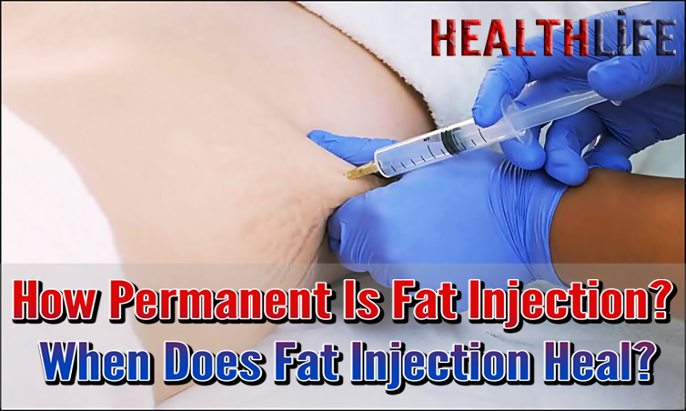 How Permanent Is Fat Injection