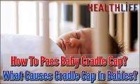 How To Pass Baby Cradle Cap