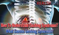 How To Understand Cushing Syndrome