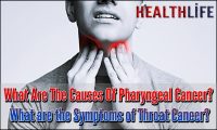 What Are The Causes Of Pharyngeal Cancer