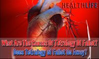 What Are The Causes Of Tetralogy Of Fallot
