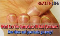 What Are The Symptoms Of Nail Psoriasis