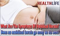 What Are The Symptoms Of Umbilical Hernia