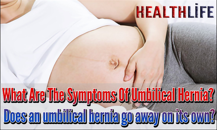 What Are The Symptoms Of Umbilical Hernia