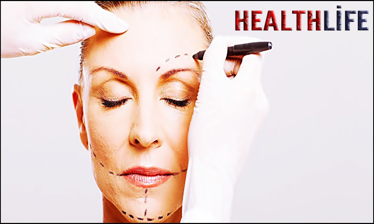 What Can Go Wrong With Facelifts