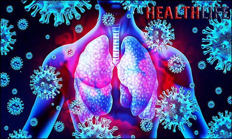 What Causes Disease Examples