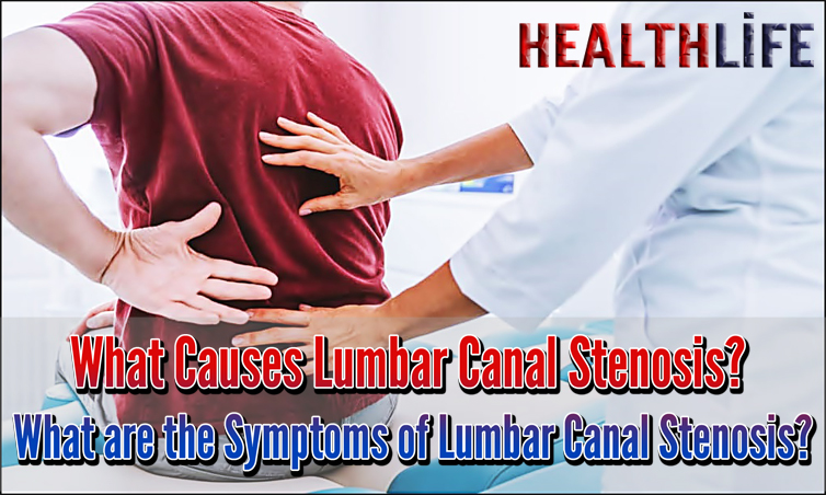 What Causes Lumbar Canal Stenosis