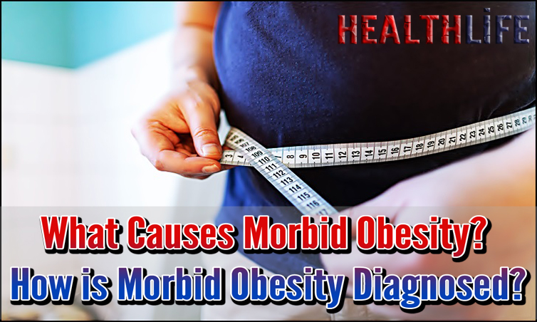 What Causes Morbid Obesity