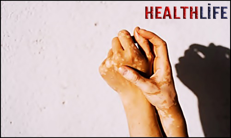 What Disease Changes Your Skin Color