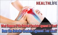 What Happens If the Anterior Cruciate Ligament Is Torn