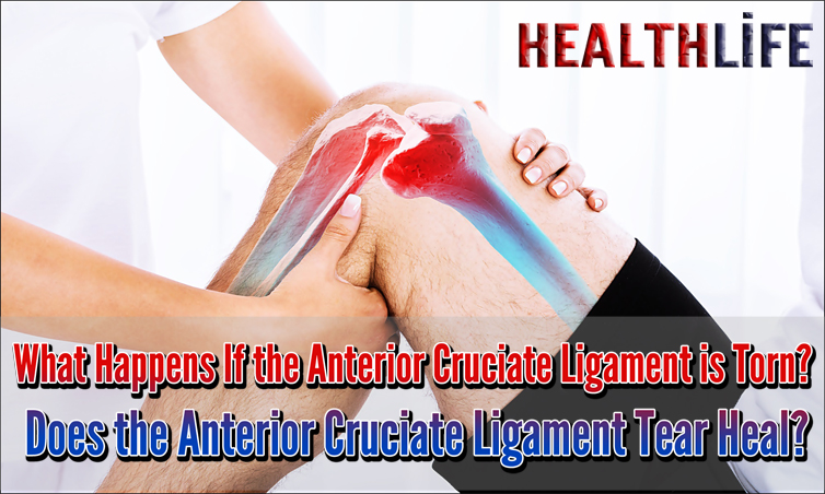 What Happens If the Anterior Cruciate Ligament Is Torn