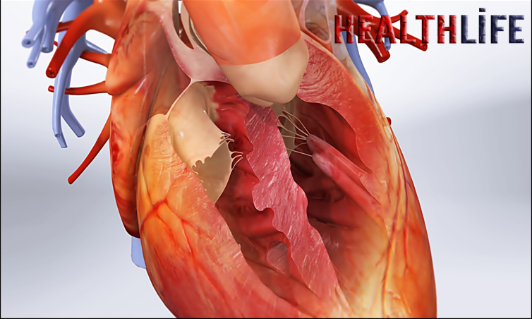 What Increases The Risk Of Tetralogy Of Fallot