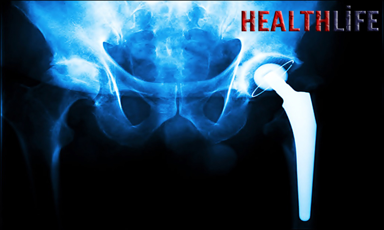 Who Can Perform Arthroscopy