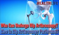 Who Can Undergo Hip Arthroscopy