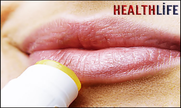 How Can I Take Care Of My Lips At Home