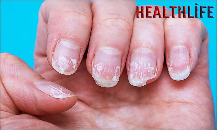 How Do You Care For Artificial Fingernails
