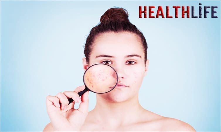 A Comprehensive Guide to SPF for Every Skin Type