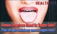 Disease Symptoms Based On Tongue Color
