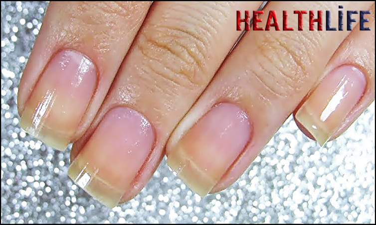 How Can I Speed up My Nail Growth