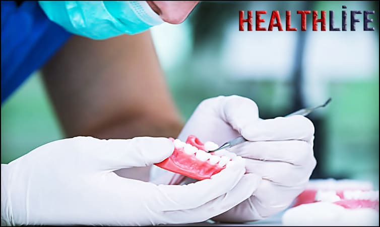 How Do You Take Care Of Prosthetic Teeth