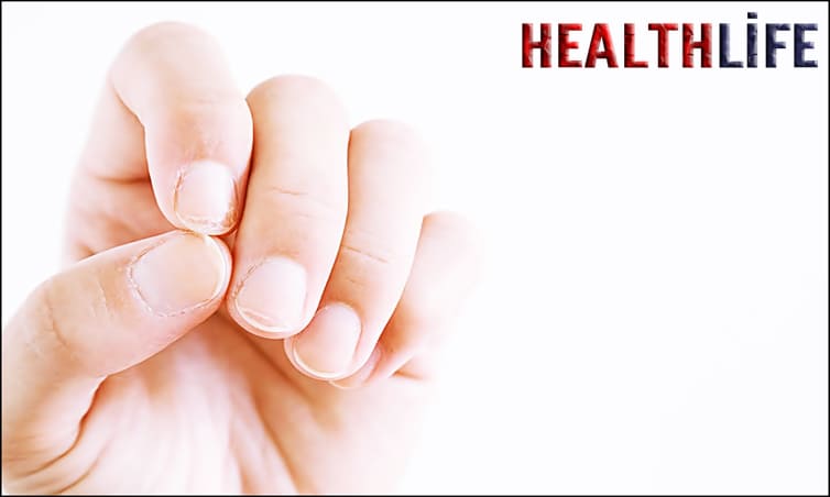 What Are 10 Diseases Caused By Vitamin Deficiency