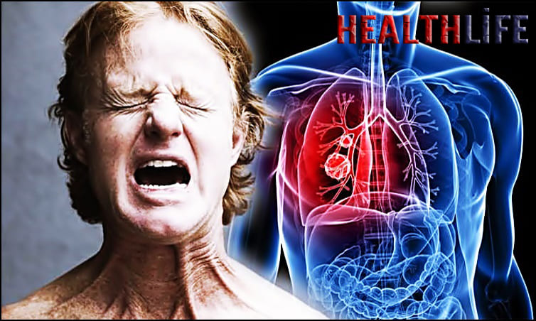 What Are The Silent Symptoms Of lung Cancer