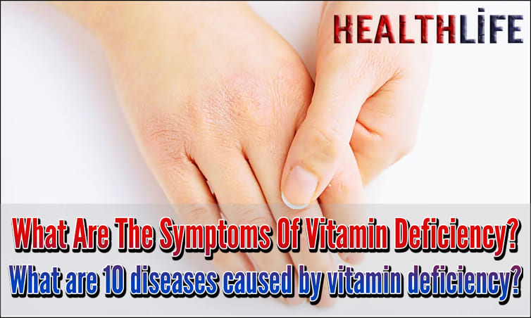 What Are The Symptoms Of Vitamin Deficiency