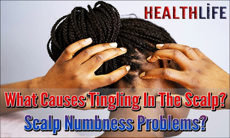 What Causes Tingling In The Scalp