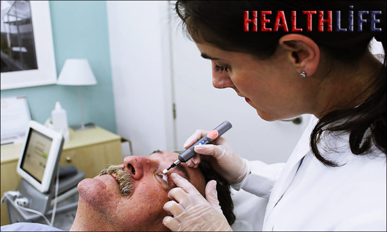 How Can I Treat An Eyelid Infection At Home