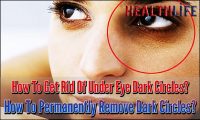 How To Get Rid Of Under Eye Dark Circles