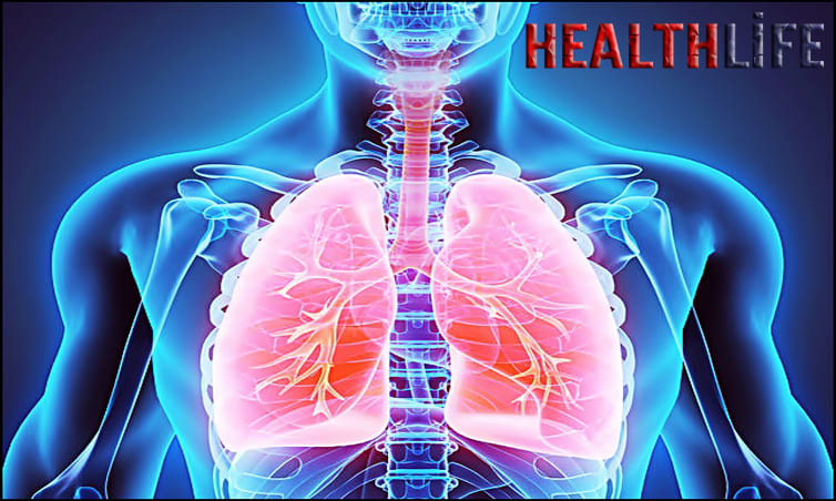 How To Protect Yourself From Legionnaires Disease