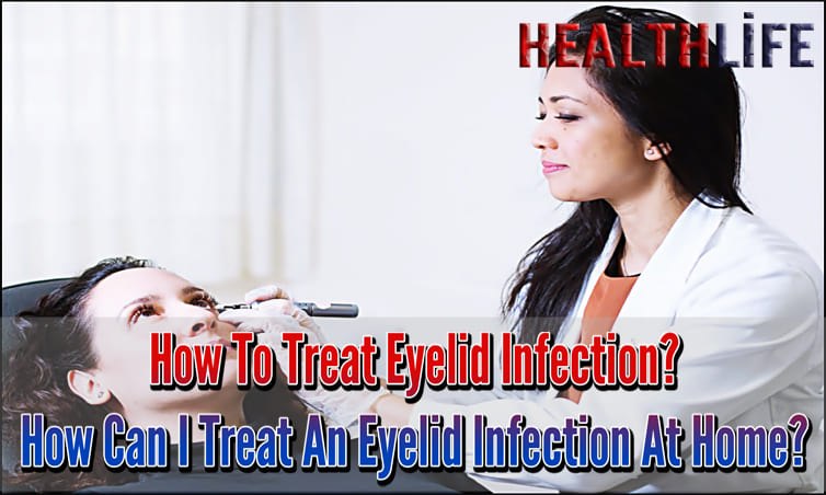 How To Treat Eyelid Infection