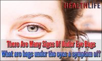 There Are Many Signs Of Under Eye Bags