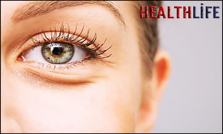What Are Bags Under The Eyes A Symptom Of