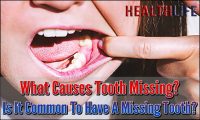 What Causes Tooth Missing
