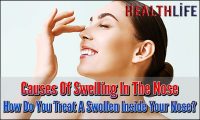 Causes Of Swelling In The Nose