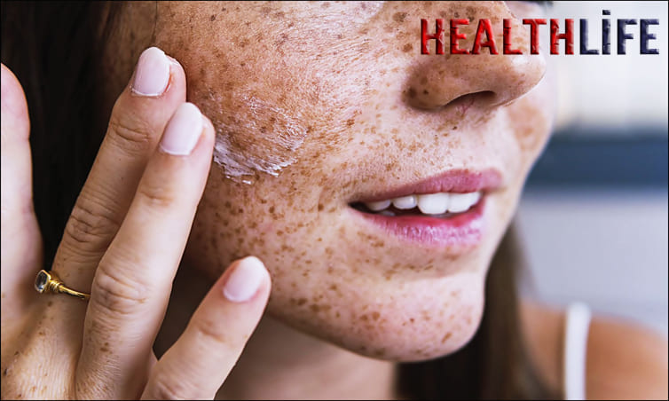 Does Vitamin C Make Freckles